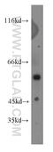 Phosphoinositide-3-Kinase Regulatory Subunit 5 antibody, 13329-1-AP, Proteintech Group, Western Blot image 