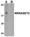 Ribonuclease T2 antibody, A05281, Boster Biological Technology, Western Blot image 