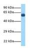 Solute Carrier Family 11 Member 2 antibody, GTX46861, GeneTex, Western Blot image 