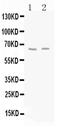 Glutamate Decarboxylase 2 antibody, PA5-79293, Invitrogen Antibodies, Western Blot image 