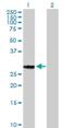 Glucose-Fructose Oxidoreductase Domain Containing 2 antibody, H00081577-B01P, Novus Biologicals, Western Blot image 