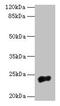 Nascent Polypeptide Associated Complex Subunit Alpha 2 antibody, A67934-100, Epigentek, Western Blot image 