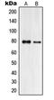 Praja Ring Finger Ubiquitin Ligase 2 antibody, MBS820454, MyBioSource, Western Blot image 