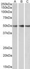 Protein Phosphatase 2 Regulatory Subunit B'Epsilon antibody, LS-C55306, Lifespan Biosciences, Western Blot image 