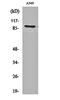 Suppression Of Tumorigenicity 14 antibody, orb161686, Biorbyt, Western Blot image 