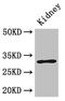 Family With Sequence Similarity 151 Member B antibody, CSB-PA740923LA01HU, Cusabio, Western Blot image 