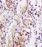 Platelet Derived Growth Factor Subunit B antibody, orb11254, Biorbyt, Immunohistochemistry paraffin image 