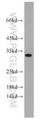Protein chibby homolog 1 antibody, 12239-1-AP, Proteintech Group, Western Blot image 