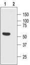 Somatostatin Receptor 1 antibody, TA329048, Origene, Western Blot image 