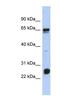 Uncharacterized protein C1orf103 antibody, NBP1-56819, Novus Biologicals, Western Blot image 
