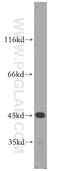Cytochrome P450 Family 2 Subfamily W Member 1 antibody, 12904-1-AP, Proteintech Group, Western Blot image 