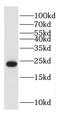 HD Domain Containing 3 antibody, FNab03807, FineTest, Western Blot image 