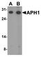 Gamma-secretase subunit APH-1A antibody, A04859, Boster Biological Technology, Western Blot image 