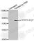 STAT3 antibody, AP0136, ABclonal Technology, Western Blot image 