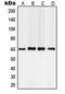 Phospholipase C Gamma 2 antibody, LS-C352674, Lifespan Biosciences, Western Blot image 