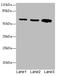 Serine palmitoyltransferase 2 antibody, A50500-100, Epigentek, Western Blot image 