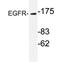 EGFR antibody, AP20334PU-N, Origene, Western Blot image 