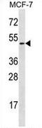 Ladinin 1 antibody, AP52438PU-N, Origene, Western Blot image 