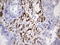 NAB2 antibody, LS-C790083, Lifespan Biosciences, Immunohistochemistry paraffin image 