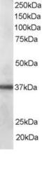 PDZ and LIM domain protein 1 antibody, 46-157, ProSci, Enzyme Linked Immunosorbent Assay image 