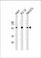 Mi antibody, M00269-3, Boster Biological Technology, Western Blot image 