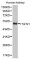 Presenilin 1 antibody, abx001799, Abbexa, Western Blot image 