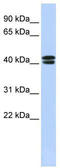 Calcium Voltage-Gated Channel Auxiliary Subunit Beta 3 antibody, TA338368, Origene, Western Blot image 