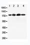 Nuclear Receptor Subfamily 3 Group C Member 2 antibody, LS-C312750, Lifespan Biosciences, Western Blot image 