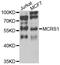 Microspherule Protein 1 antibody, STJ110364, St John