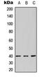 Arginine Vasopressin Receptor 2 antibody, LS-C358920, Lifespan Biosciences, Western Blot image 