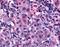 Discoidin Domain Receptor Tyrosine Kinase 1 antibody, orb85992, Biorbyt, Immunohistochemistry paraffin image 