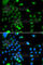 Ubiquitin Conjugating Enzyme E2 J2 antibody, A7316, ABclonal Technology, Immunohistochemistry paraffin image 