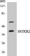 Homeobox B2 antibody, LS-C292065, Lifespan Biosciences, Western Blot image 