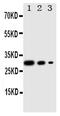 Adiponectin, C1Q And Collagen Domain Containing antibody, PA2014, Boster Biological Technology, Western Blot image 