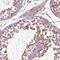 Von Willebrand Factor A Domain Containing 5B1 antibody, NBP2-57637, Novus Biologicals, Immunohistochemistry paraffin image 