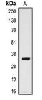DIA1 antibody, LS-C352112, Lifespan Biosciences, Western Blot image 