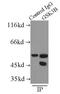 Glycogen Synthase Kinase 3 Beta antibody, FNab03676, FineTest, Immunoprecipitation image 