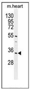 Chromosome 18 Open Reading Frame 25 antibody, AP51067PU-N, Origene, Western Blot image 