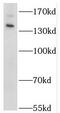 Serine/Threonine Kinase 36 antibody, FNab08335, FineTest, Western Blot image 