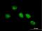 Centrosomal Protein 104 antibody, H00009731-B01P, Novus Biologicals, Immunofluorescence image 