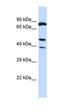 Fc Fragment Of IgG Receptor Ib antibody, orb327456, Biorbyt, Western Blot image 