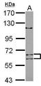 Adenosine Deaminase Domain Containing 1 antibody, GTX121377, GeneTex, Western Blot image 
