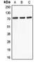 ATP Binding Cassette Subfamily D Member 4 antibody, orb214487, Biorbyt, Western Blot image 