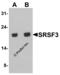 Serine And Arginine Rich Splicing Factor 3 antibody, 8179, ProSci Inc, Western Blot image 