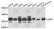 Cyclin Dependent Kinase 1 antibody, A0030, ABclonal Technology, Western Blot image 