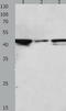 Mitogen-Activated Protein Kinase Kinase 2 antibody, TA321907, Origene, Western Blot image 