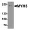 Myosin-3 antibody, TA349138, Origene, Western Blot image 