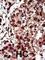 Diacylglycerol Kinase Iota antibody, abx033886, Abbexa, Western Blot image 