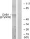 Disabled homolog 1 antibody, LS-C117330, Lifespan Biosciences, Western Blot image 