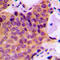 Mitogen-Activated Protein Kinase 9 antibody, LS-C352717, Lifespan Biosciences, Immunohistochemistry paraffin image 